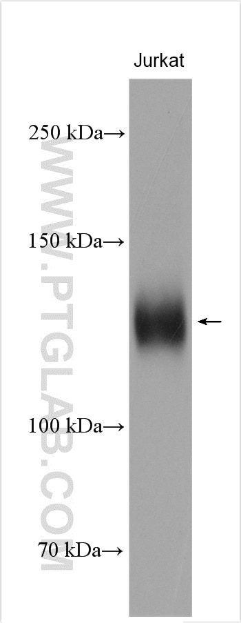 Western Blot (WB) analysis of Jurkat cells using NFATC2 Polyclonal antibody (22023-1-AP)