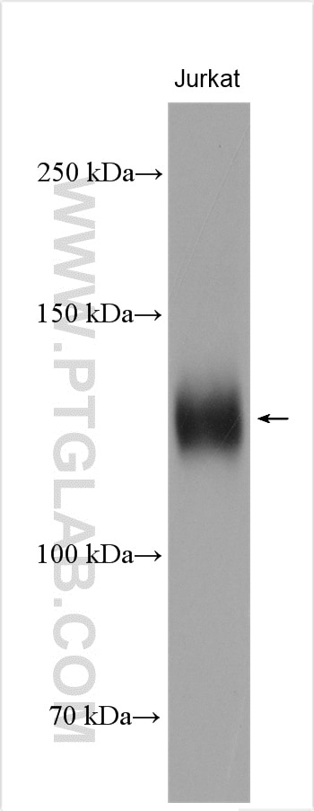 WB analysis of Jurkat using 22023-1-AP