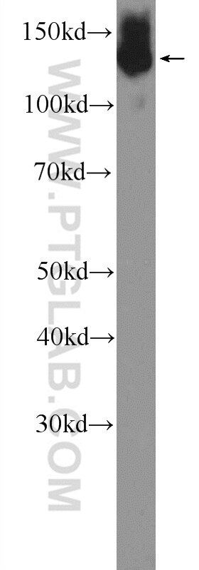 NFATC2 Polyclonal antibody