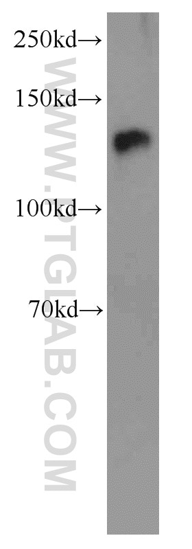 Western Blot (WB) analysis of Sp2/0 cells using NFATC2 Polyclonal antibody (22023-1-AP)