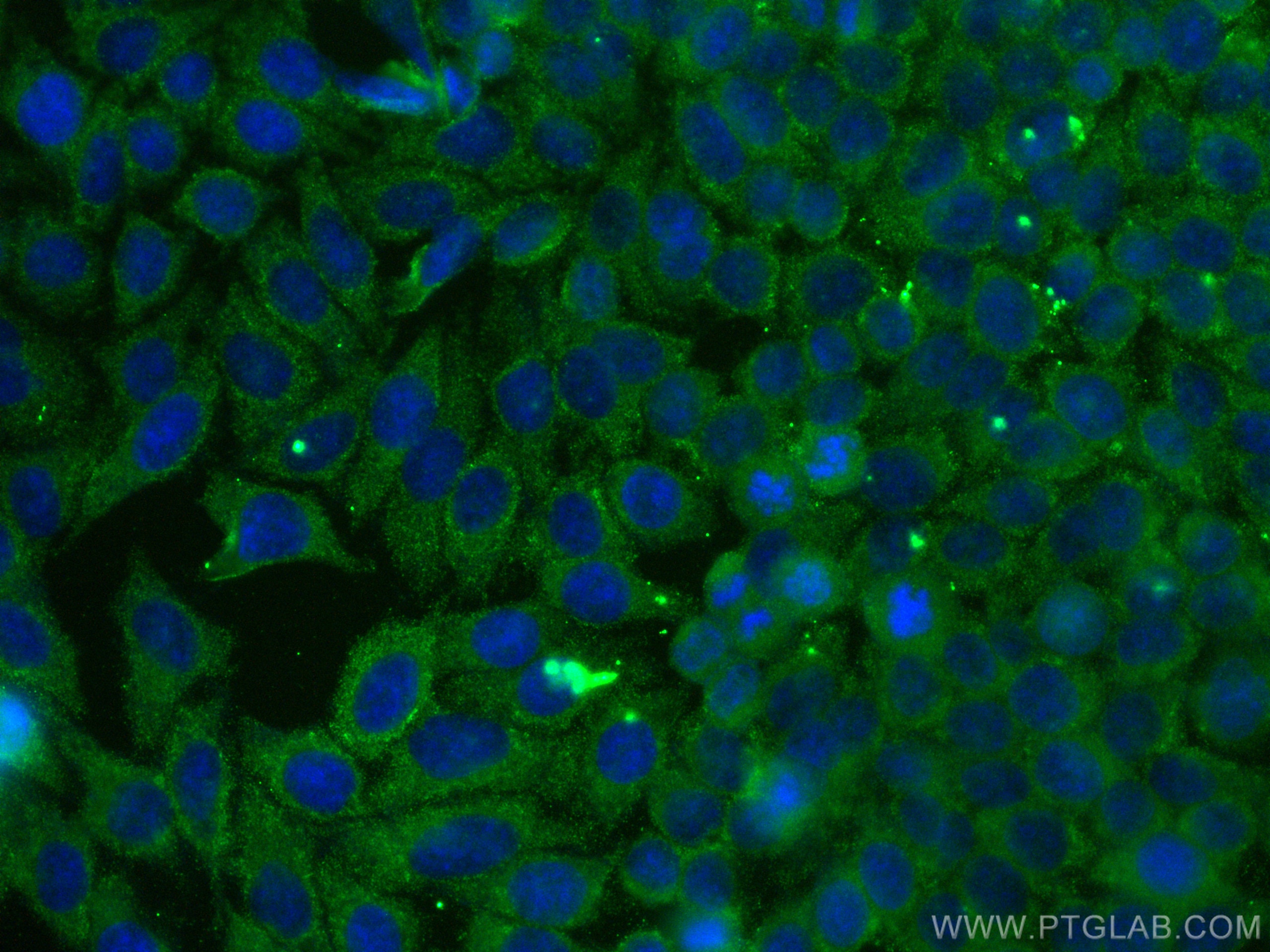 Immunofluorescence (IF) / fluorescent staining of HepG2 cells using NFATC2 Monoclonal antibody (66917-1-Ig)