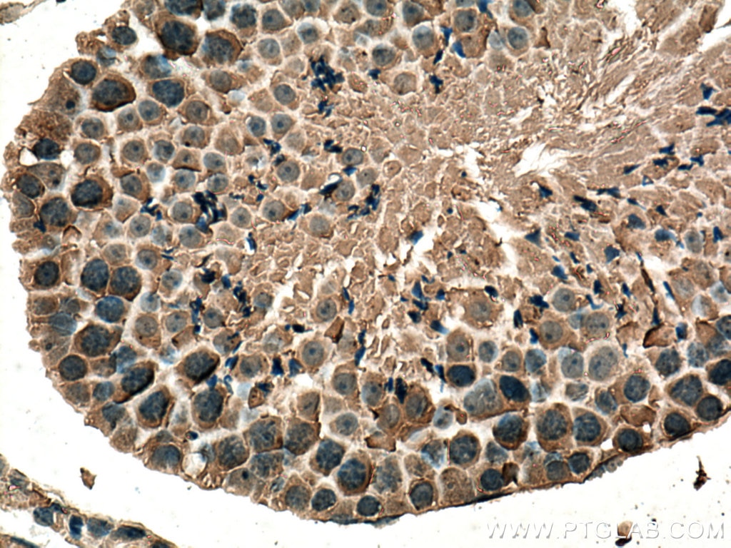 Immunohistochemistry (IHC) staining of mouse testis tissue using NFATC2 Monoclonal antibody (66917-1-Ig)