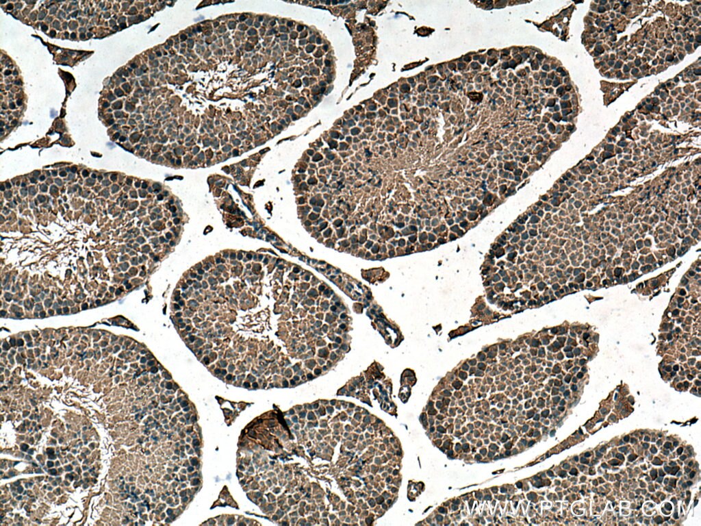 IHC staining of mouse testis using 66917-1-Ig