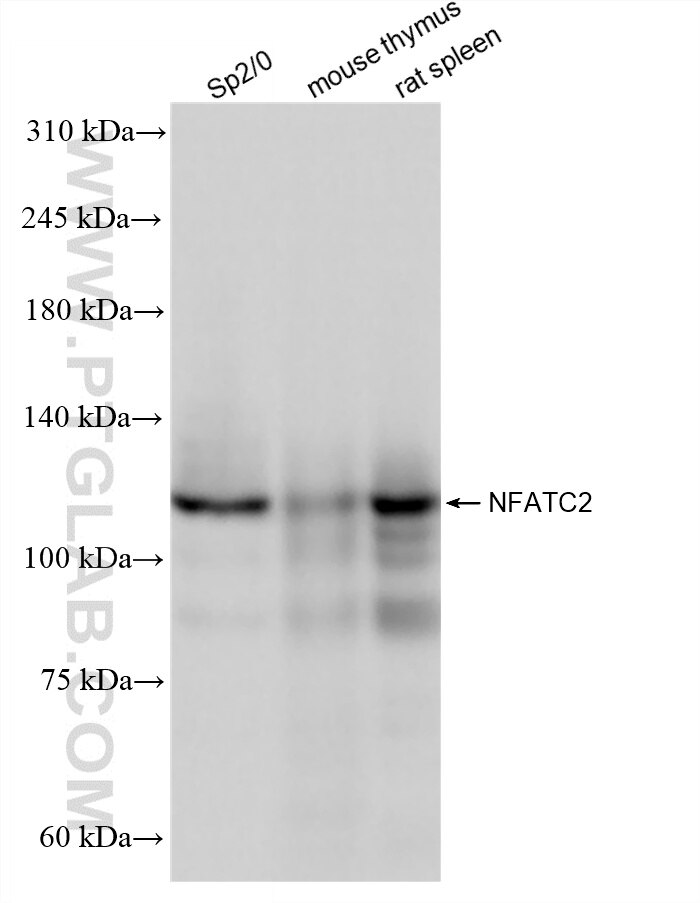 WB analysis using 87895-1-RR (same clone as 87895-1-PBS) Western Blot (WB) analysis of various lysates using NFATC2 Recombinant monoclonal antibody (87895-1-RR)