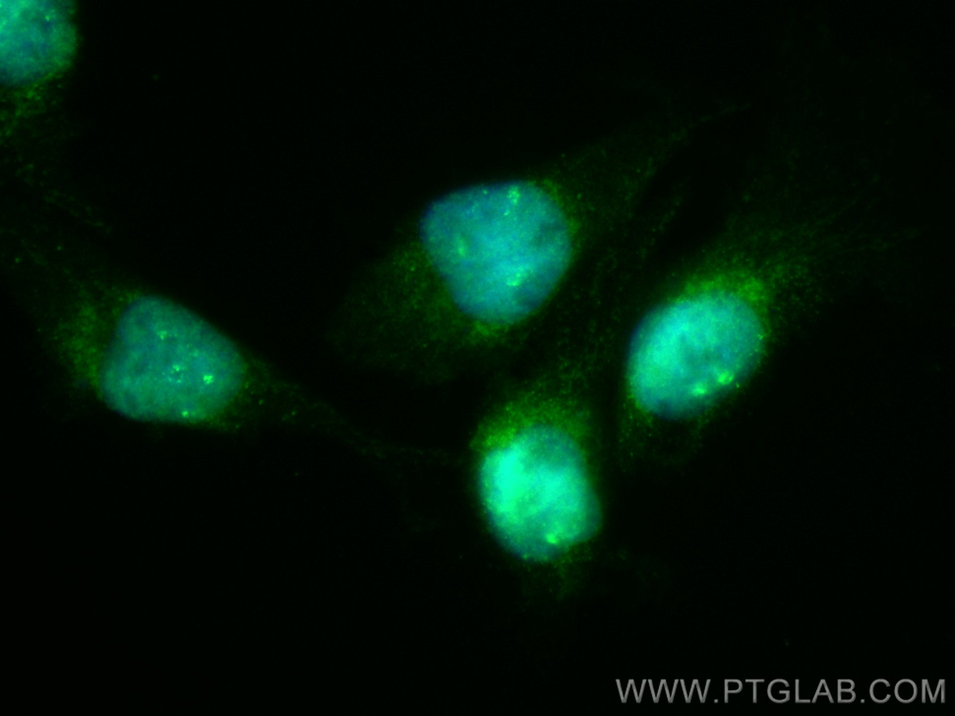 Immunofluorescence (IF) / fluorescent staining of U-251 cells using CoraLite® Plus 488-conjugated NFATC2 Polyclonal an (CL488-22023)