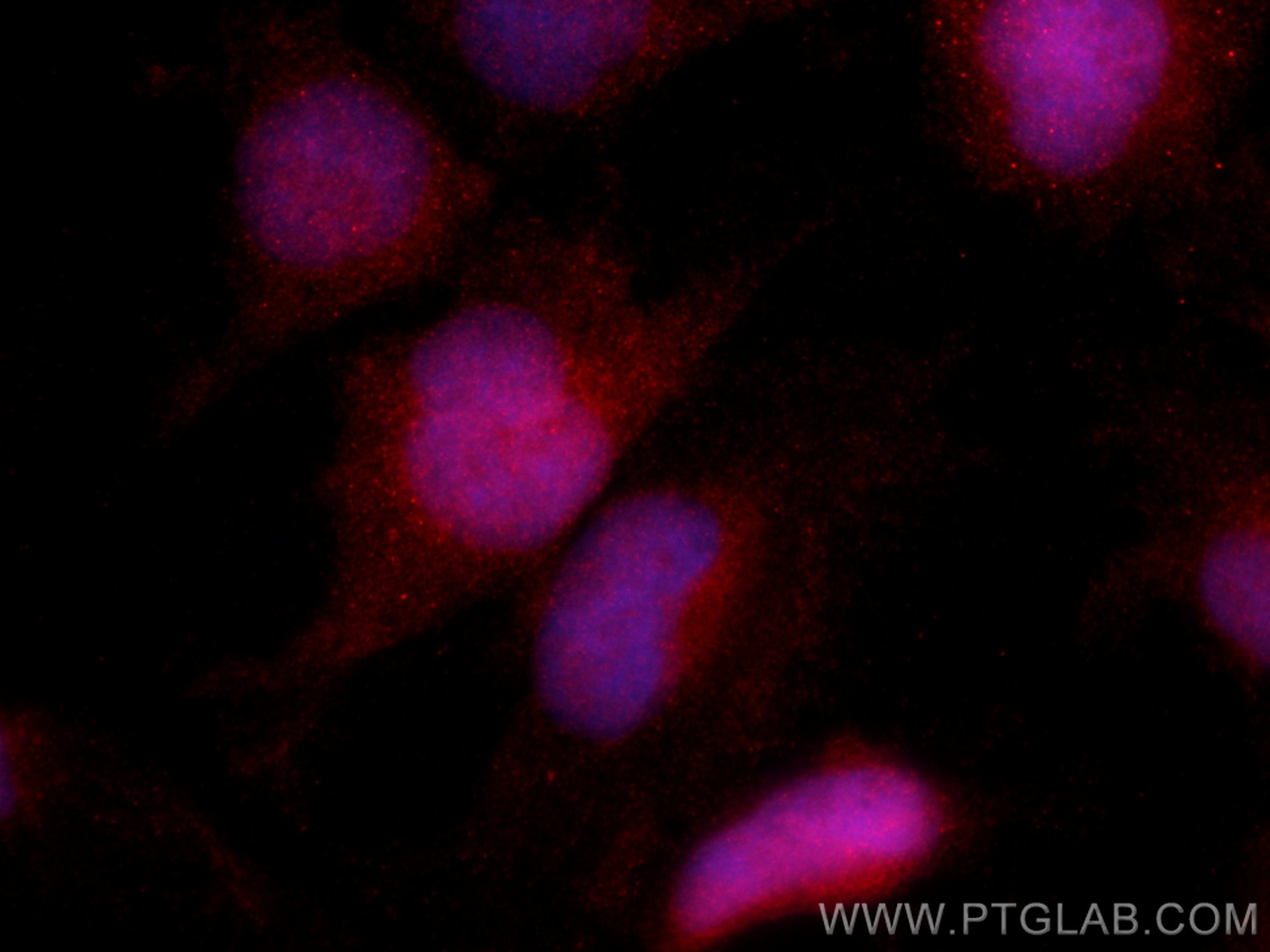 Immunofluorescence (IF) / fluorescent staining of U-251 cells using CoraLite®594-conjugated NFATC2 Polyclonal antibody (CL594-22023)
