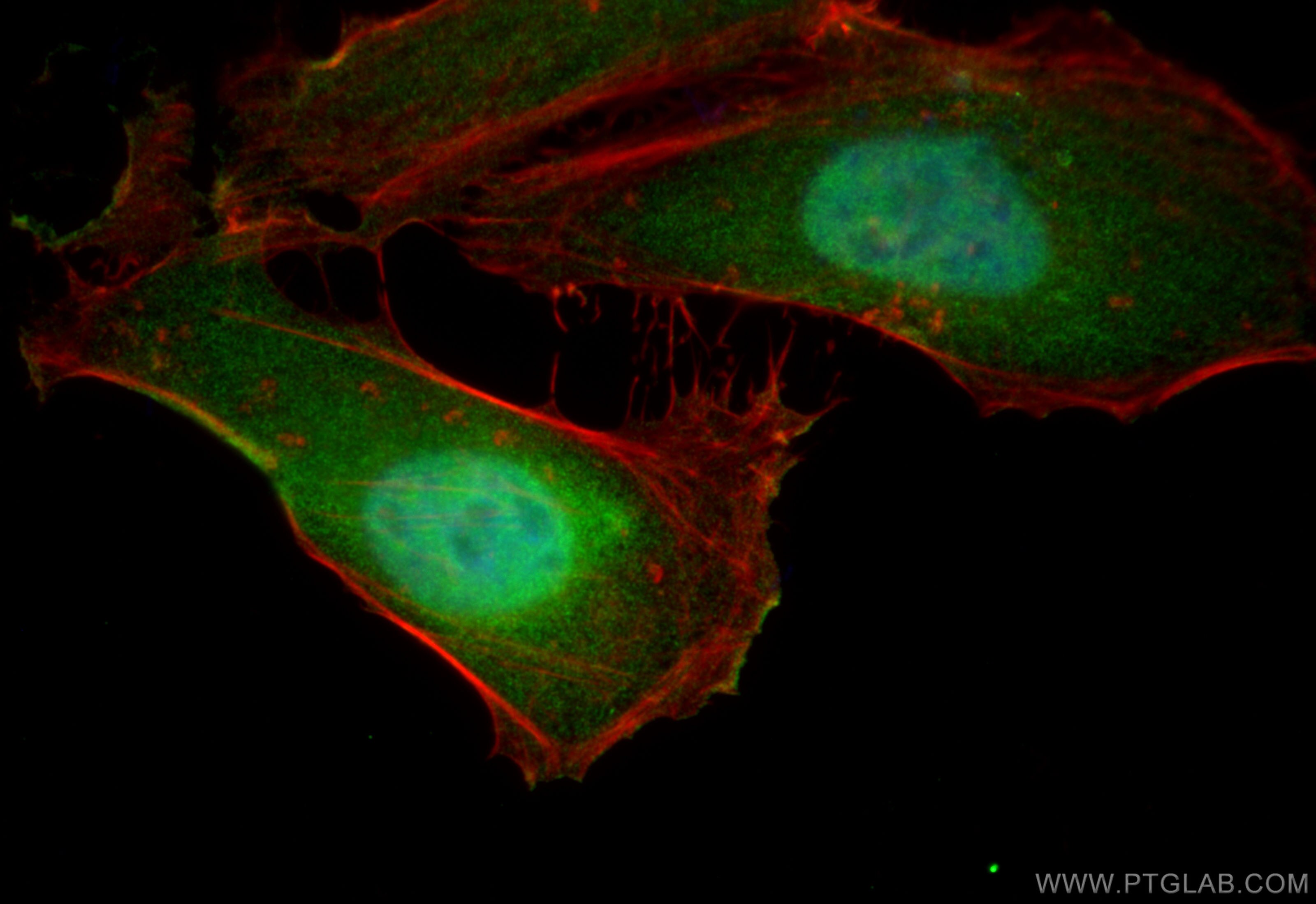 Immunofluorescence (IF) / fluorescent staining of HeLa cells using NFATC2IP Polyclonal antibody (11667-1-AP)
