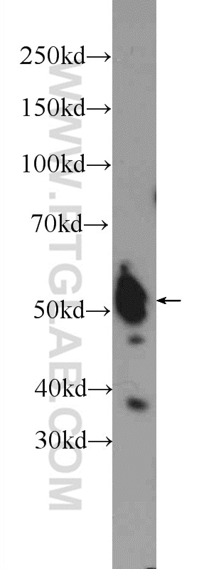 Western Blot (WB) analysis of mouse thymus tissue using NFATC2IP Polyclonal antibody (11667-1-AP)