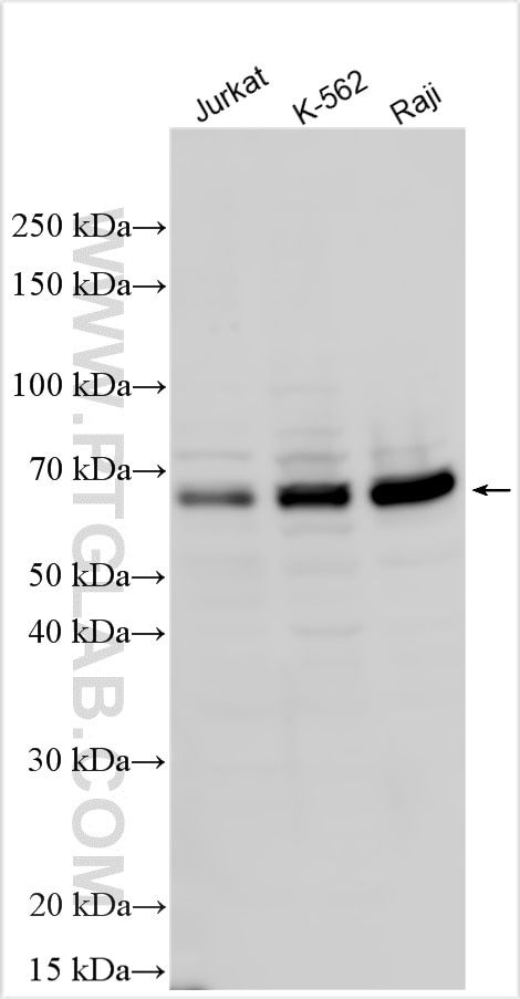 Western Blot (WB) analysis of various lysates using NFATC2IP Polyclonal antibody (11667-1-AP)