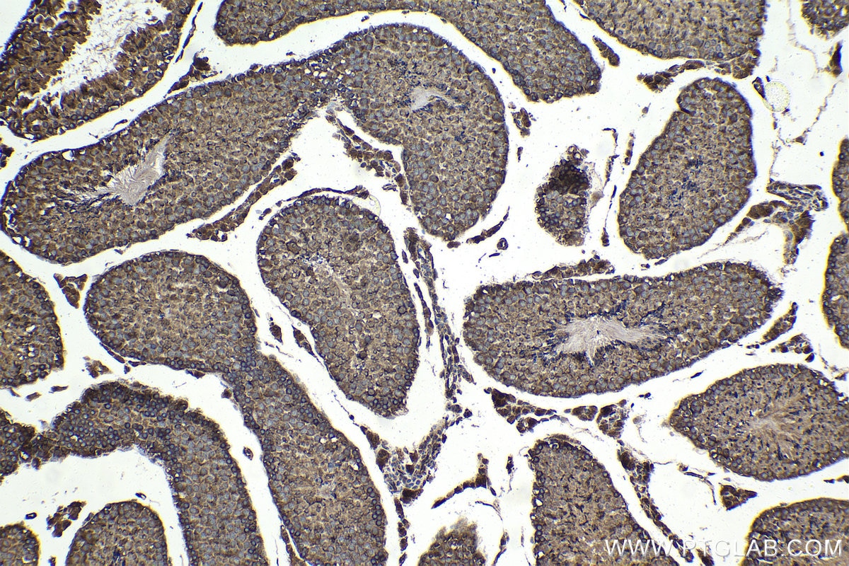 Immunohistochemistry (IHC) staining of mouse testis tissue using NFATC3 Polyclonal antibody (18222-1-AP)