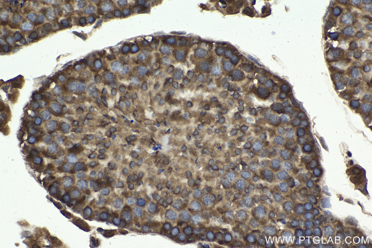 Immunohistochemistry (IHC) staining of mouse testis tissue using NFATC3 Polyclonal antibody (18222-1-AP)