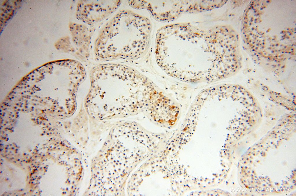 Immunohistochemistry (IHC) staining of human testis tissue using NFATC3 Polyclonal antibody (18222-1-AP)