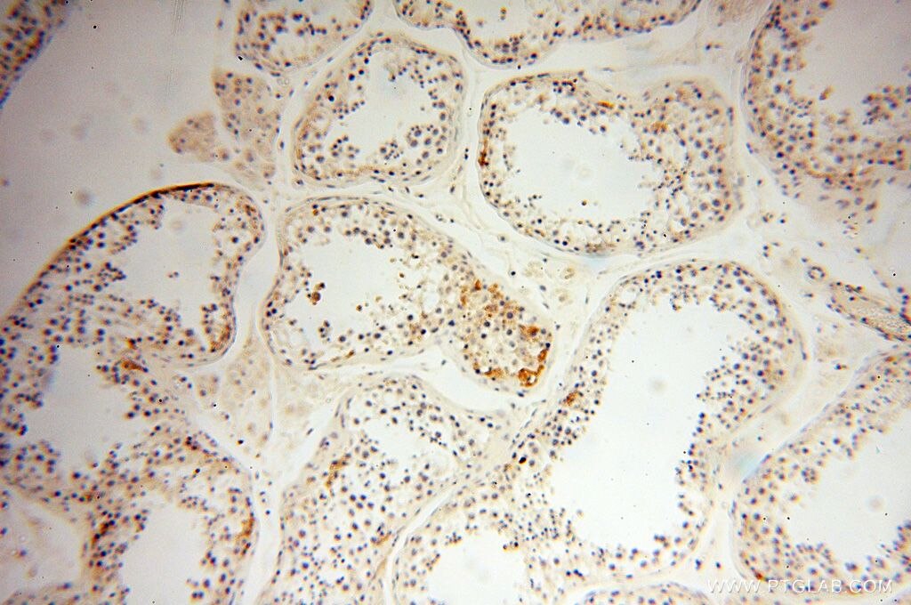 IHC staining of human testis using 18222-1-AP