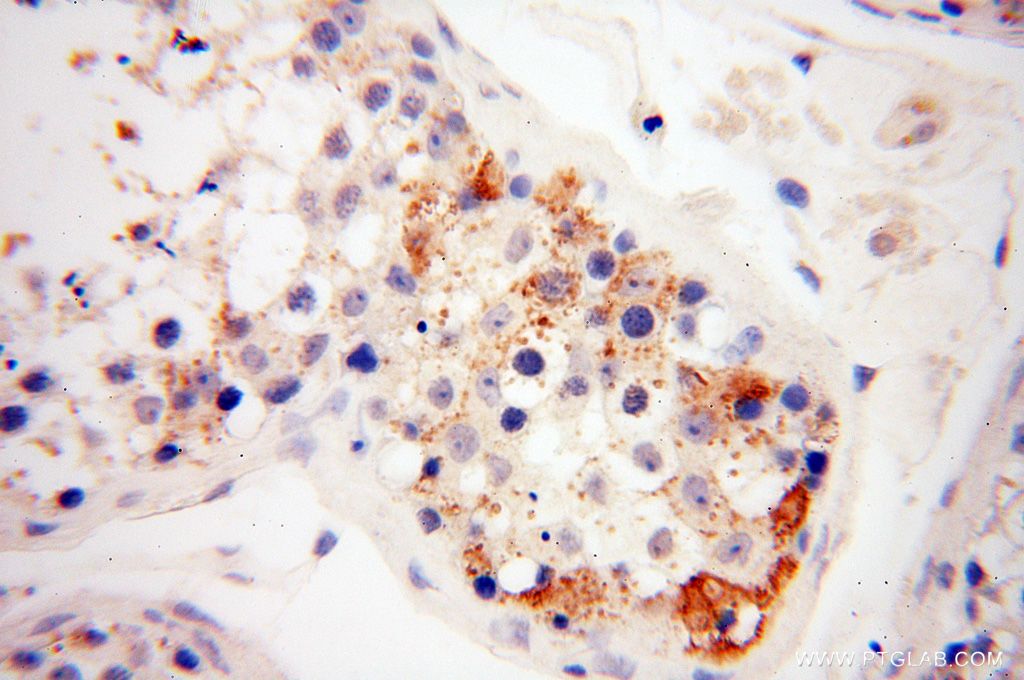 Immunohistochemistry (IHC) staining of human testis tissue using NFATC3 Polyclonal antibody (18222-1-AP)