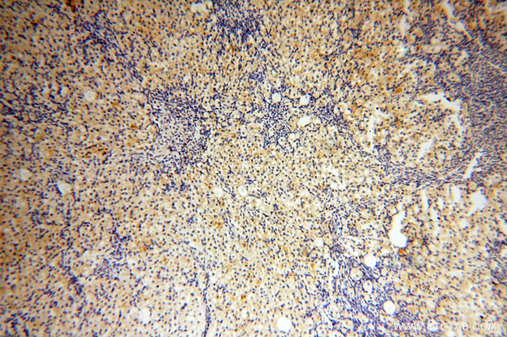 Immunohistochemistry (IHC) staining of human ovary tissue using NFATC3 Polyclonal antibody (18222-1-AP)