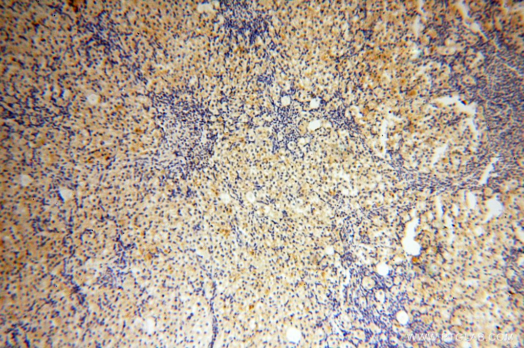 IHC staining of human ovary using 18222-1-AP