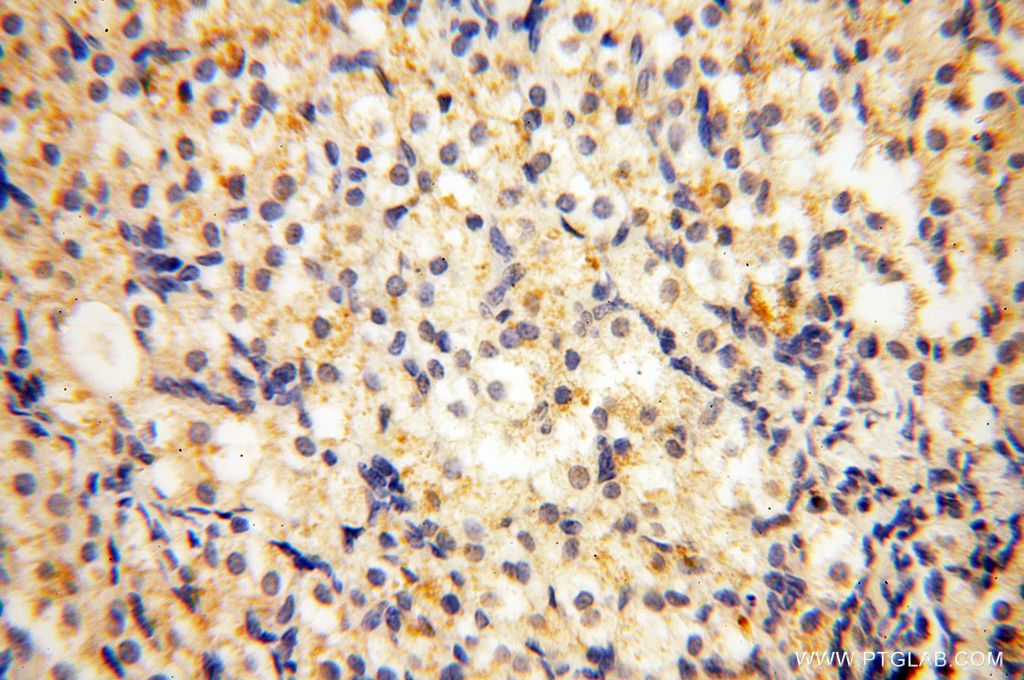 Immunohistochemistry (IHC) staining of human ovary tissue using NFATC3 Polyclonal antibody (18222-1-AP)
