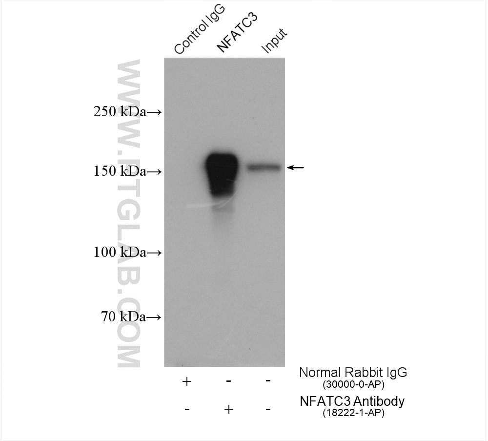 Immunoprecipitation (IP) experiment of K-562 cells using NFATC3 Polyclonal antibody (18222-1-AP)