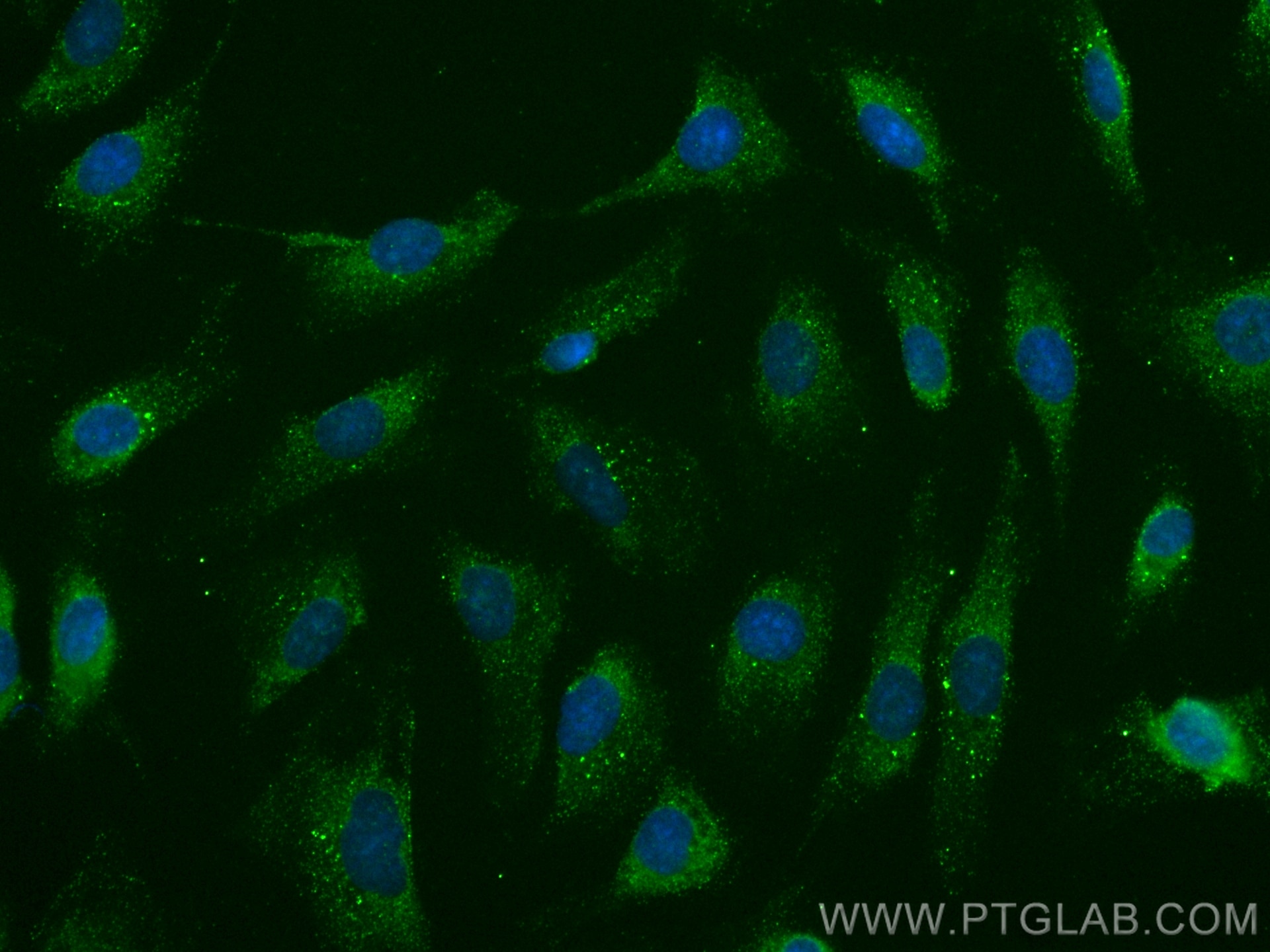 Immunofluorescence (IF) / fluorescent staining of SKOV-3 cells using NFATC3 Monoclonal antibody (66924-1-Ig)