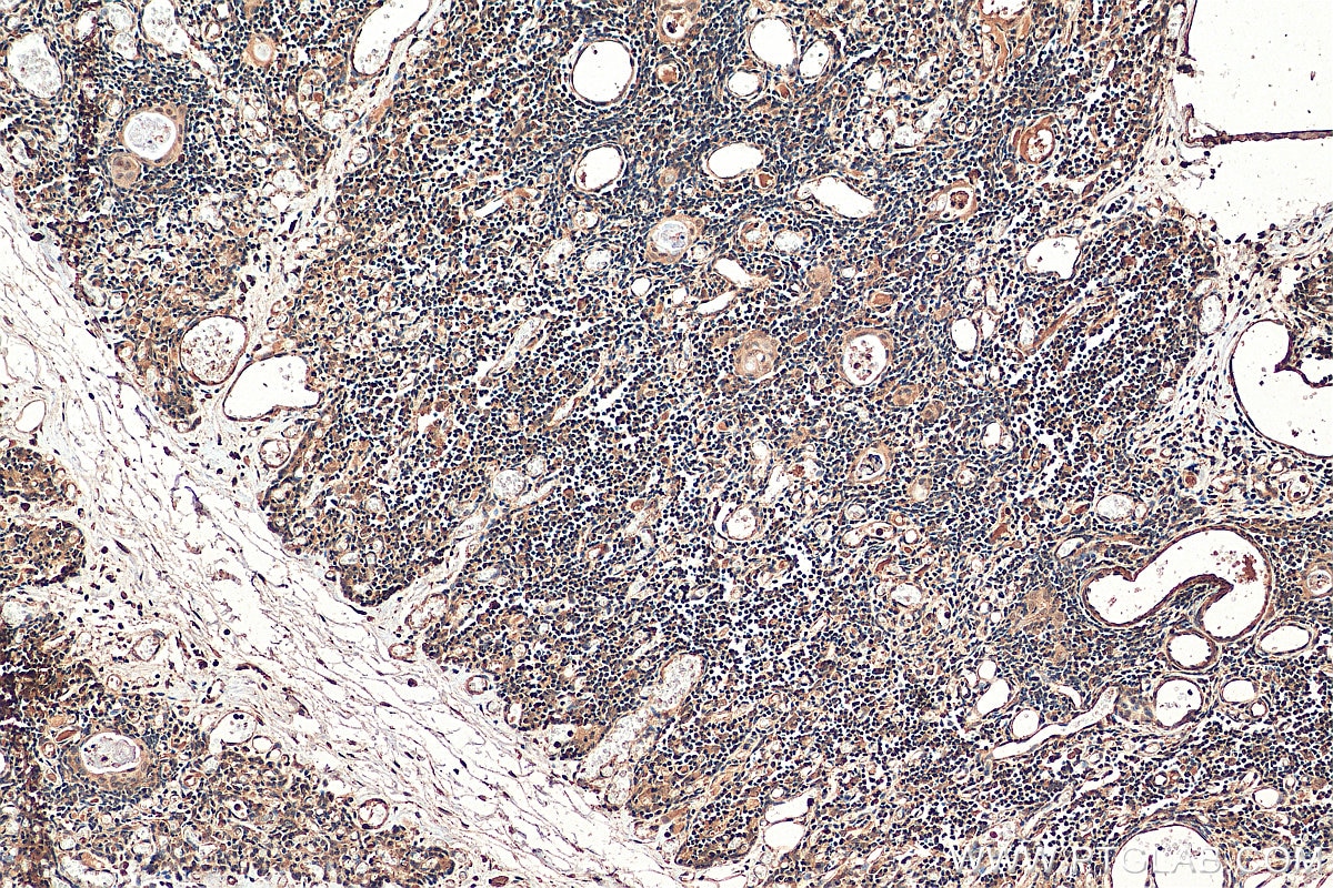 Immunohistochemistry (IHC) staining of human thymus tissue using NFATC3 Monoclonal antibody (66924-1-Ig)