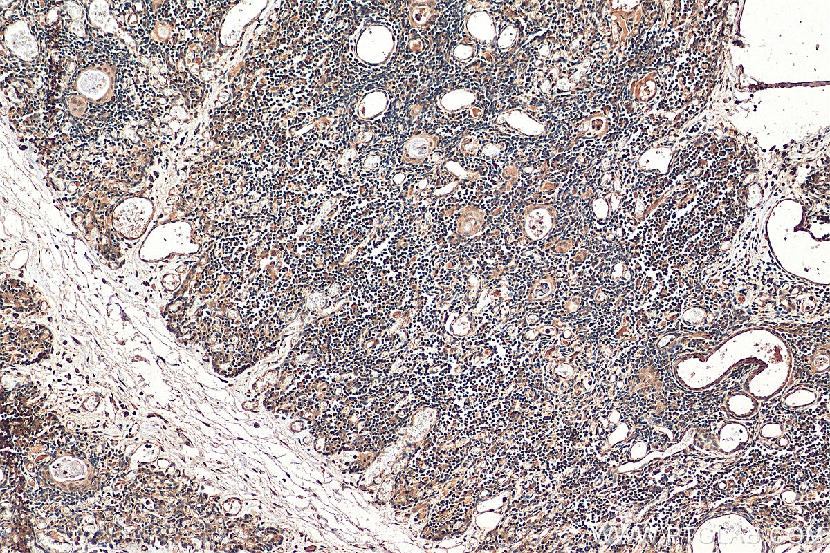 IHC staining of human thymus using 66924-1-Ig