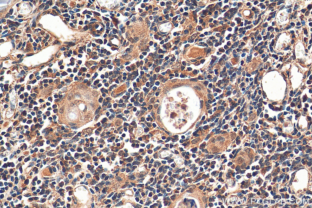 Immunohistochemistry (IHC) staining of human thymus tissue using NFATC3 Monoclonal antibody (66924-1-Ig)