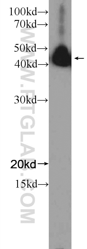 Western Blot (WB) analysis of K-562 cells using NFE2 Polyclonal antibody (11089-1-AP)