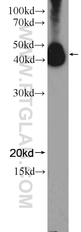 Western Blot (WB) analysis of K-562 cells using NFE2 Polyclonal antibody (11089-1-AP)