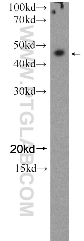 Western Blot (WB) analysis of U-937 cells using NFE2 Polyclonal antibody (11089-1-AP)