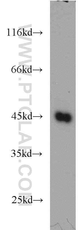 Western Blot (WB) analysis of K-562 cells using NFE2 Polyclonal antibody (11089-1-AP)