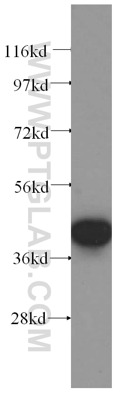 Western Blot (WB) analysis of K-562 cells using NFE2 Polyclonal antibody (11089-1-AP)