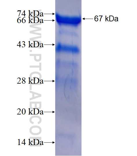 NFE2 fusion protein Ag1570 SDS-PAGE