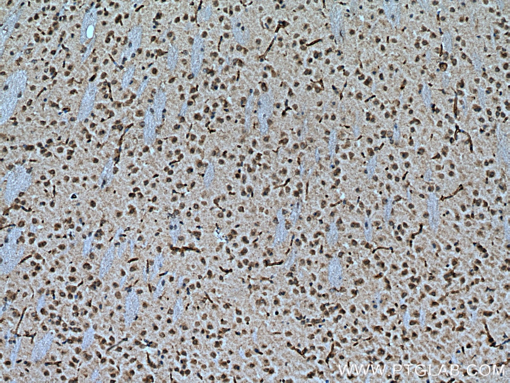 Immunohistochemistry (IHC) staining of mouse brain tissue using NFE2L1 Polyclonal antibody (12936-1-AP)