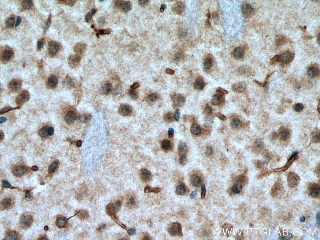 Immunohistochemistry (IHC) staining of mouse brain tissue using NFE2L1 Polyclonal antibody (12936-1-AP)