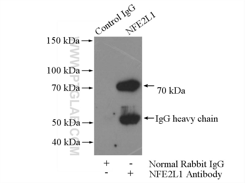 Immunoprecipitation (IP) experiment of mouse skeletal muscle tissue using NFE2L1 Polyclonal antibody (12936-1-AP)