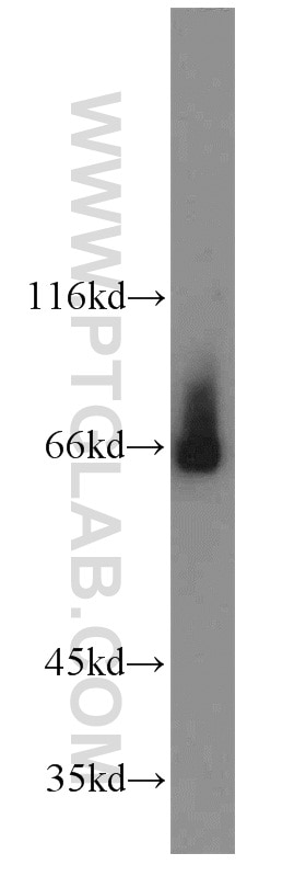 Western Blot (WB) analysis of Fetal mouse bone tissue using NFE2L1 Polyclonal antibody (12936-1-AP)