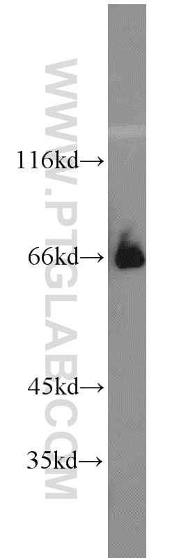 Western Blot (WB) analysis of Fetal mouse bone tissue using NFE2L1 Polyclonal antibody (12936-1-AP)