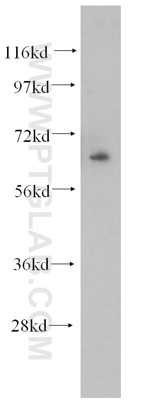 Western Blot (WB) analysis of mouse skeletal muscle tissue using NFE2L1 Polyclonal antibody (12936-1-AP)