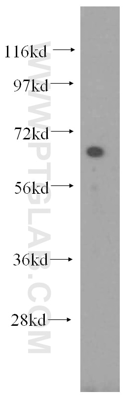 Western Blot (WB) analysis of HepG2 cells using NFE2L1 Polyclonal antibody (12936-1-AP)