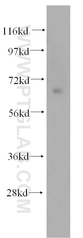 Western Blot (WB) analysis of K-562 cells using NFE2L1 Polyclonal antibody (12936-1-AP)