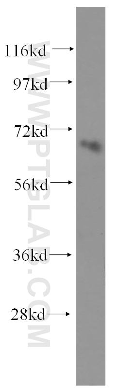 Western Blot (WB) analysis of Jurkat cells using NFE2L1 Polyclonal antibody (12936-1-AP)
