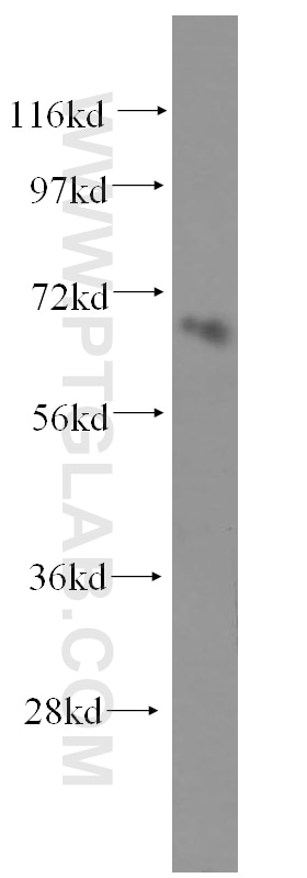 Western Blot (WB) analysis of Jurkat cells using NFE2L1 Polyclonal antibody (12936-1-AP)