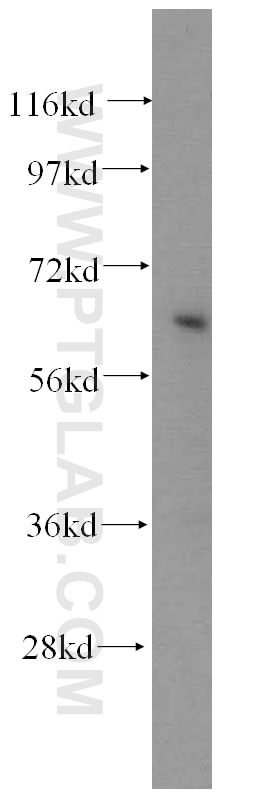 Western Blot (WB) analysis of HeLa cells using NFE2L1 Polyclonal antibody (12936-1-AP)