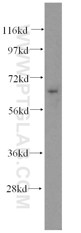 Western Blot (WB) analysis of K-562 cells using NFE2L1 Polyclonal antibody (12936-1-AP)