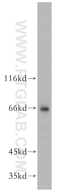 Western Blot (WB) analysis of mouse skeletal muscle tissue using NFE2L1 Polyclonal antibody (12936-1-AP)
