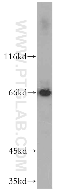 Western Blot (WB) analysis of HepG2 cells using NFE2L1 Polyclonal antibody (12936-1-AP)