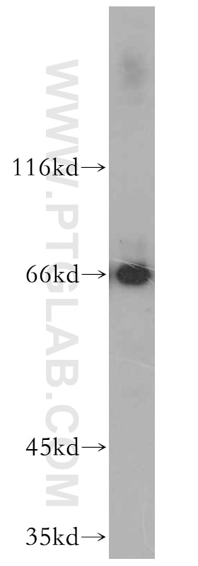 WB analysis of HepG2 using 12936-1-AP