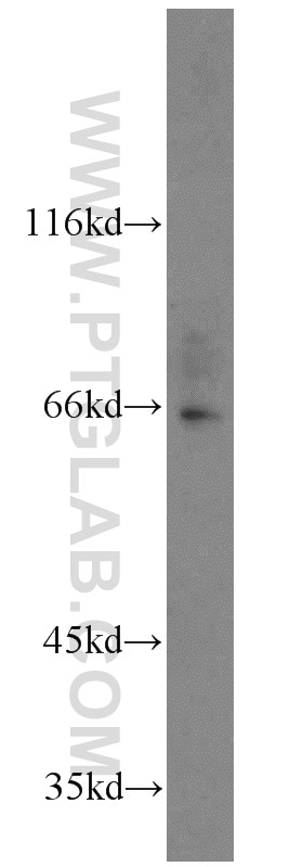 Western Blot (WB) analysis of Jurkat cells using NFE2L1 Polyclonal antibody (12936-1-AP)