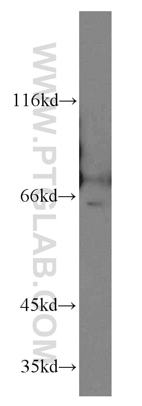 Western Blot (WB) analysis of HeLa cells using NFE2L1 Polyclonal antibody (12936-1-AP)