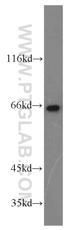 WB analysis of K-562 using 12936-1-AP